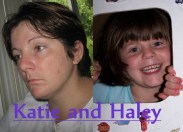 Katie and Her Daughter Haley Both Have JHD